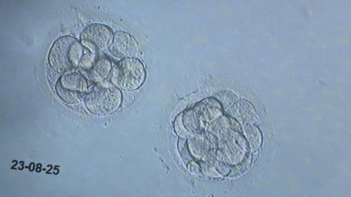 Embryos used in IVF seen through microscope