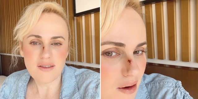 rebel wilson stitches split photo