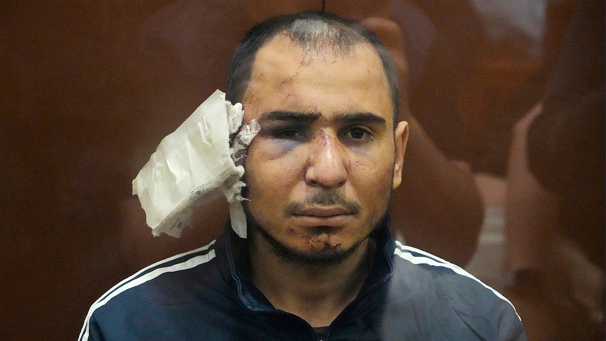 Beaten Moscow suspect