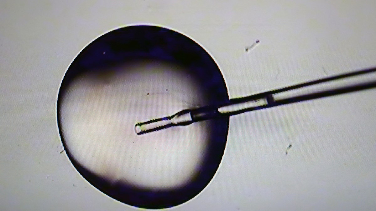 In vitro fertilization