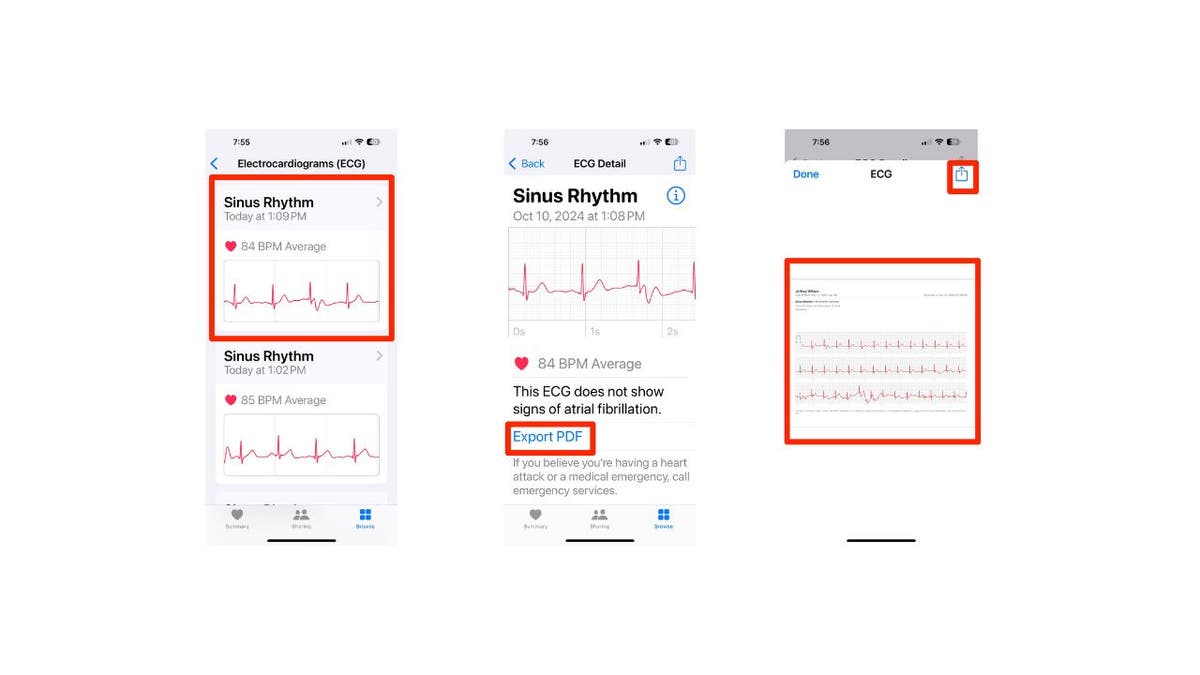 ekg app 9